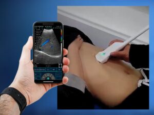 ecógrafo portátil C10RC